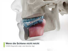 Wenn die Schiene nicht reicht: CCDS-Diagnostik zeigt, was darunter liegt