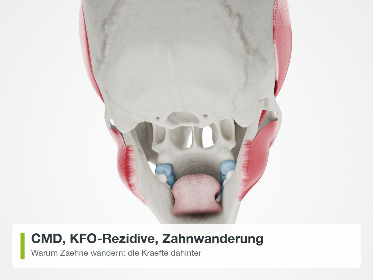 CMD, KFO-Rezidive, Zahnwanderung: die Kraefte dahinter